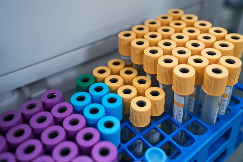 Blood samples in test tube rack at a laboratory